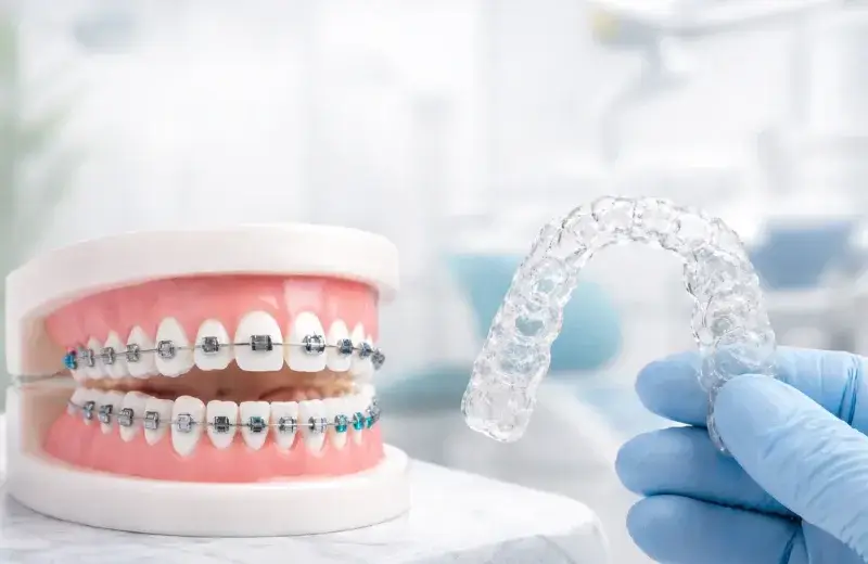 Braces & Clear Aligners at Hi Tech Dental Clinic Bandra
