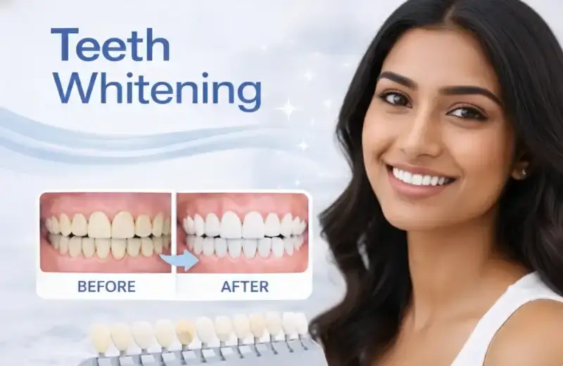 Teeth whitening at the hi tech dental clinic bandra