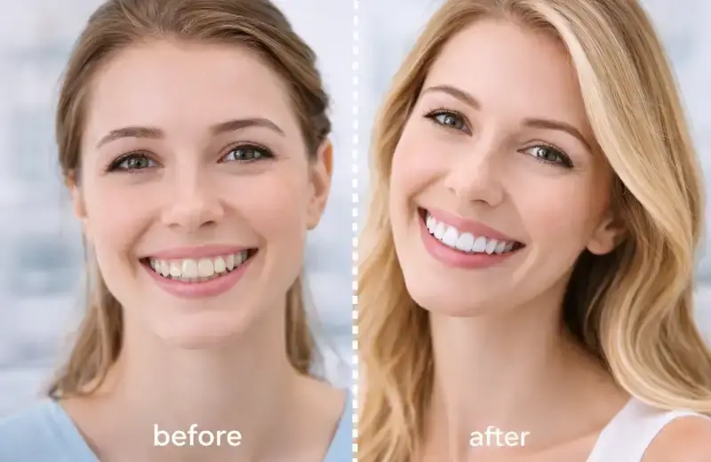 smile mekaover hi tech dental clinic bandra